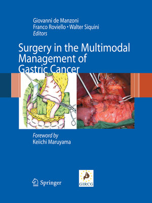 cover image of Surgery in the Multimodal Management of Gastric Cancer